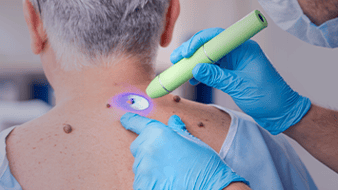 Pós-Graduação Digital: Pós-graduação em Dermatologia Oncológica